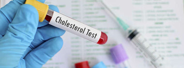What you need to know about cholesterol