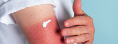 What You Need to Know About Medications and Sun Sensitivity