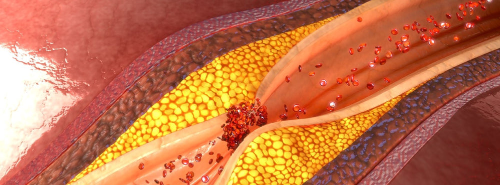 Cholesterol FAQs: Part 1