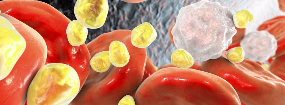 Cholesterol FAQs: Part 2
