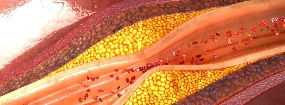 What I tell my patients: How I explain heart disease