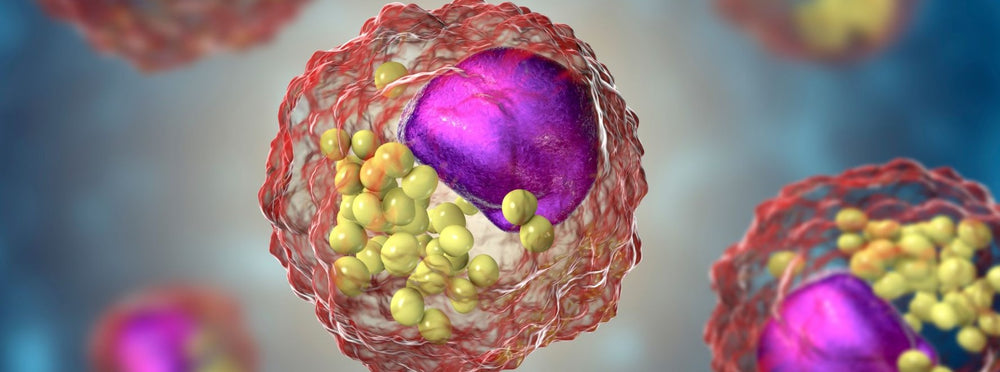 What causes high LDL cholesterol?