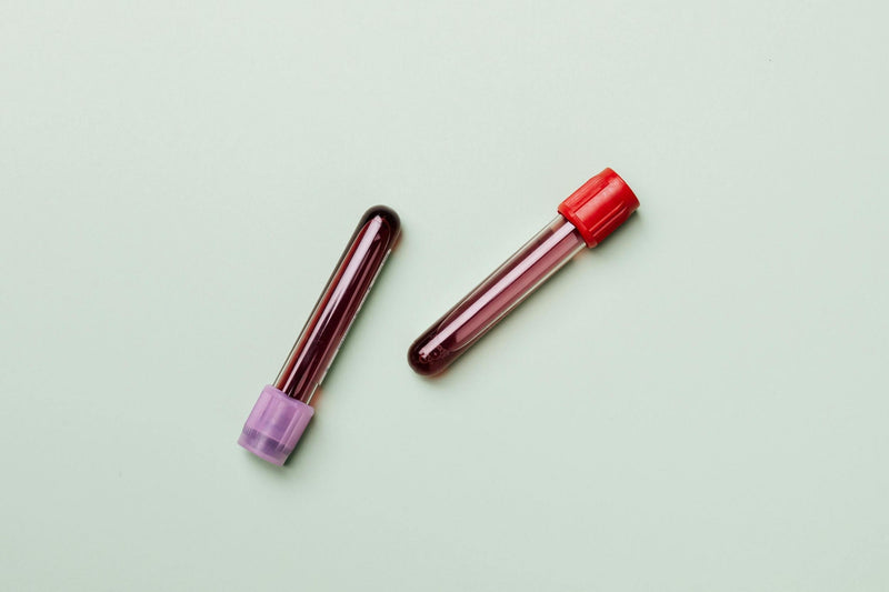 Lipoprotein(a) and apolipoprotein B blood tests for heart risk