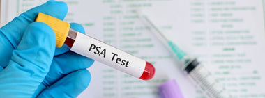 How To Improve Heart Health and Prostate Health Through Diet