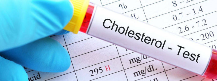 Cholesterol Test Tub