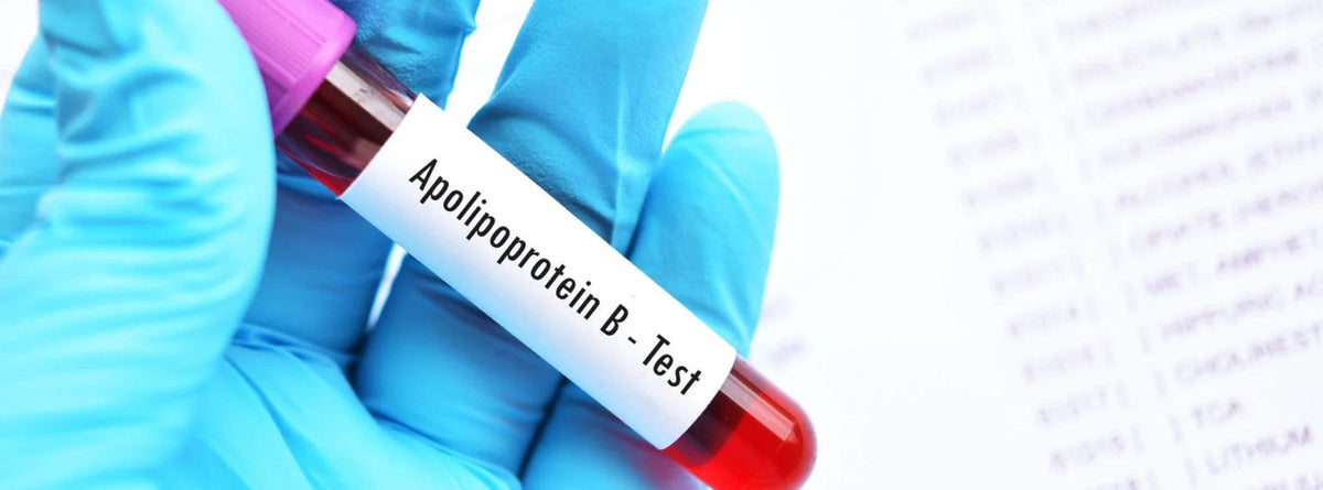 A lab requisition and blood sample for an apolipoprotein B (ApoB) cholesterol test