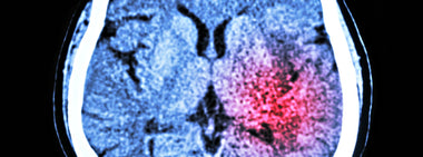 “Remember … Only YOU can prevent strokes.”