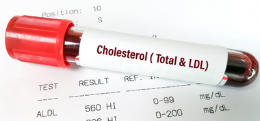 Cholesterol Confusion: What You Really Need to Know About Dietary vs. Blood Cholesterol