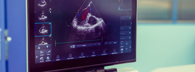 To Screen or not to Screen?