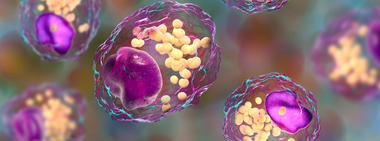 There’s more to LDL cholesterol: Particle size and number