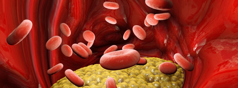 Cholesterol FAQs:  Part 3
