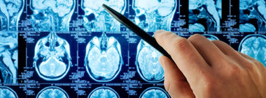 Hand holding a pen pointing to xray of a brain and skull