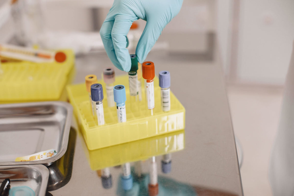 Blood test tubes in a laboratory rack for cholesterol testing